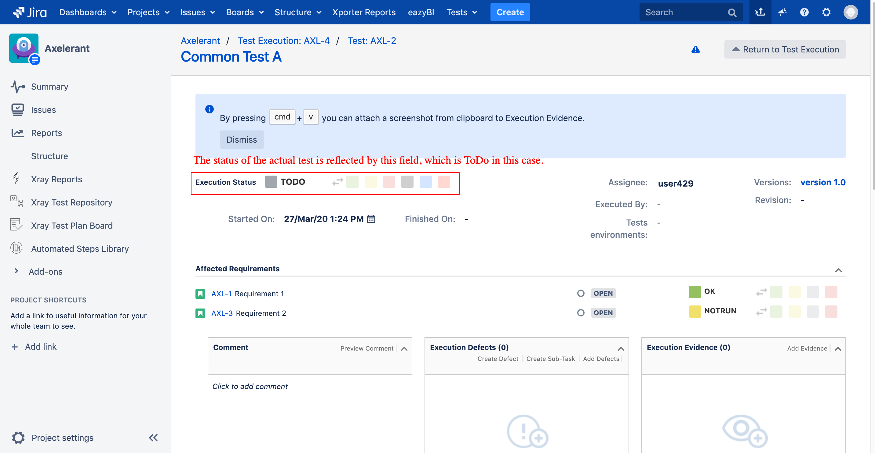 screenshot of Jira board